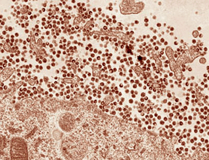 Image: HIV-1 particles (dark circles) lacking Vpu are unable to release themselves from the surface of their host cell, as tetherin keeps them glued to the surface of the cell’s outer membrane, or causes them to be sucked back in and digested within the cell (Photo courtesy of Rockefeller University).